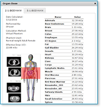 Organ Dose